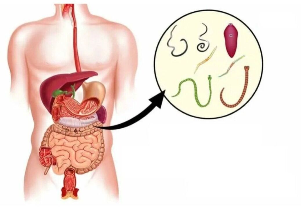 parassiti in diversi organi