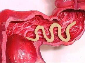 parassiti nel corpo umano perché appaiono